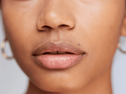 Upper Lip Laser Hair Removal